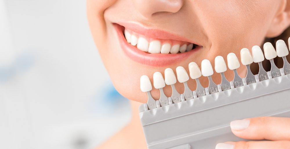 هناك العديد من الخيارات التجميلية لعلاج المشكلة - ShutterStock
