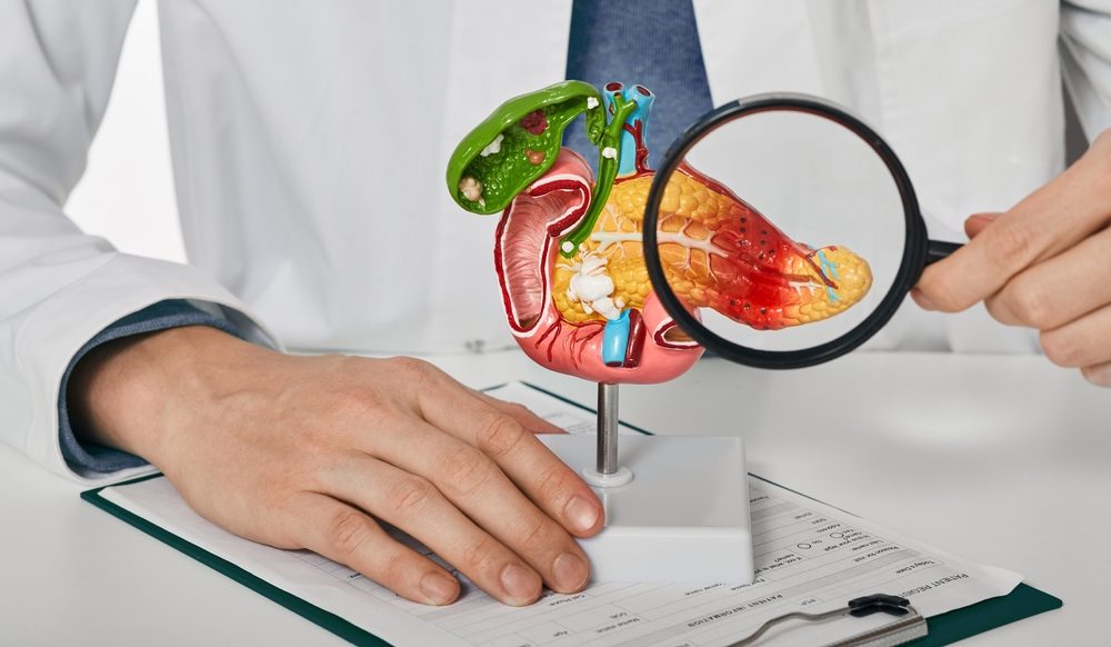يعاني المصاب بتلك الحالة مشكلة في إنتاج البنكرياس ما يكفي من الإنزيمات - ShutterStock