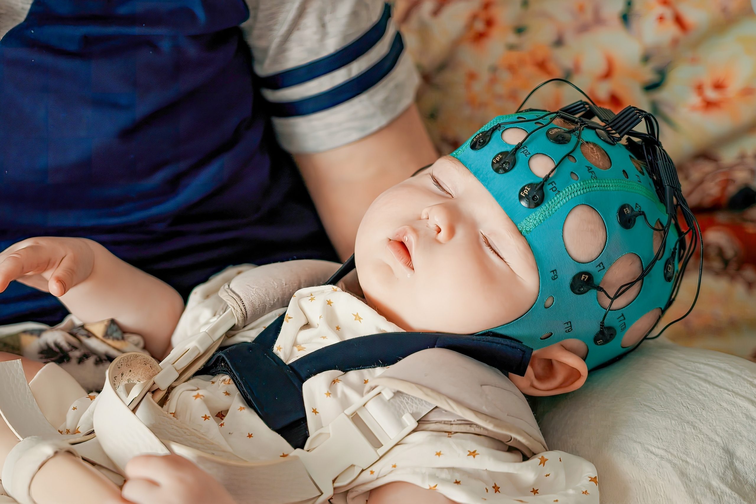 الأطفال نوبات الصرع