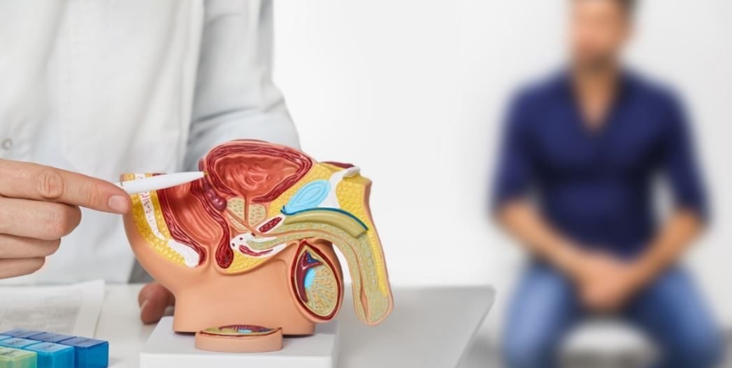 سرطان البروستاتا