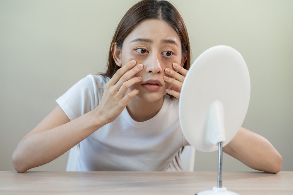 الهالات السوداء| shutterstock