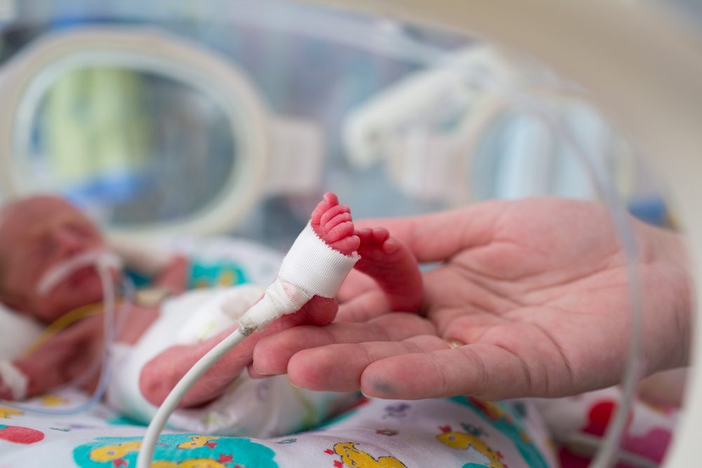طفل خديج يتلقى الرعاية  المركزة - shutterstock