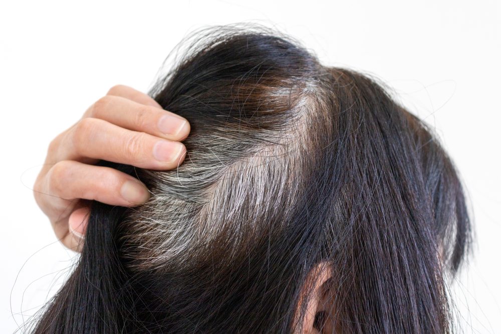 ظهور الشيب في سن مبكرة| shutterstock