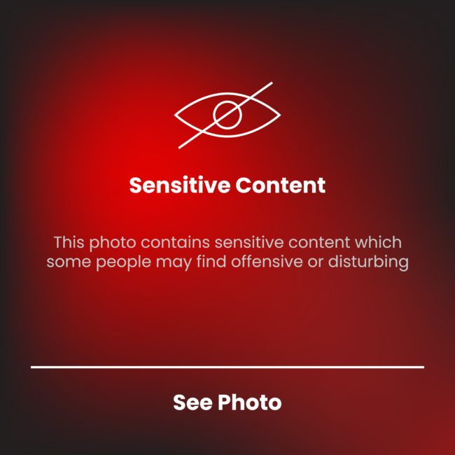 قد تسبب صدمة نفسية وفقدان مؤقت للذاكرة.. ما هو تأثير مشاهدة الصور الدموية ومقاطع الفيديو القاسية؟