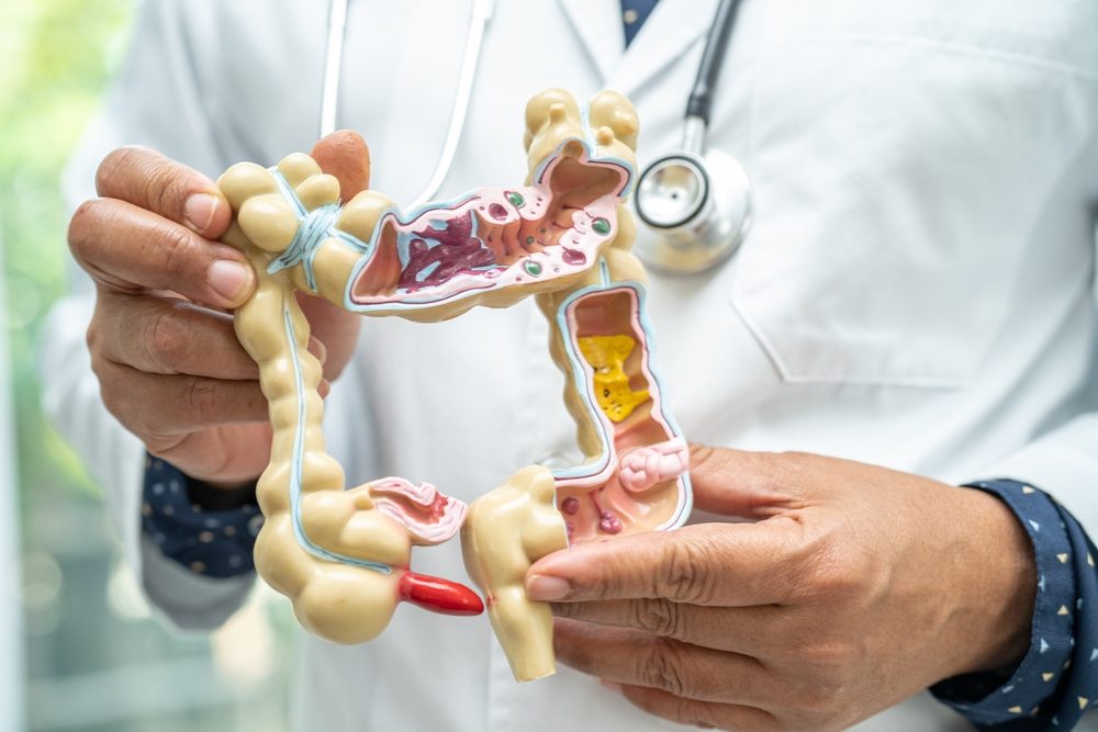 حمية البحر الأبيض المتوسط وعلاقتها بصحة الامعاء| shutterstock