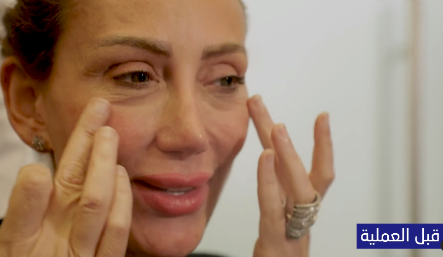 ريهام سعيد قبل التجميل من فيديو نادر صعب| مواقع التواصل