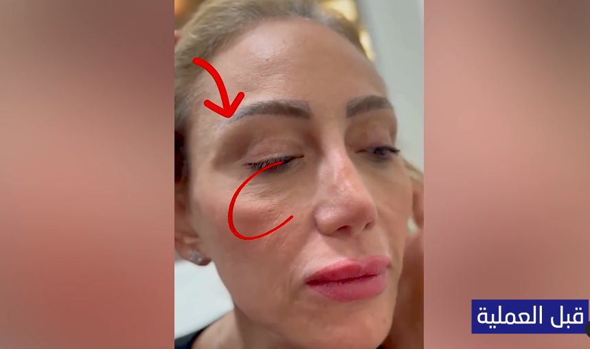 ريهام سعيد قبل التجميل من فيديو نادر صعب| مواقع التواصل