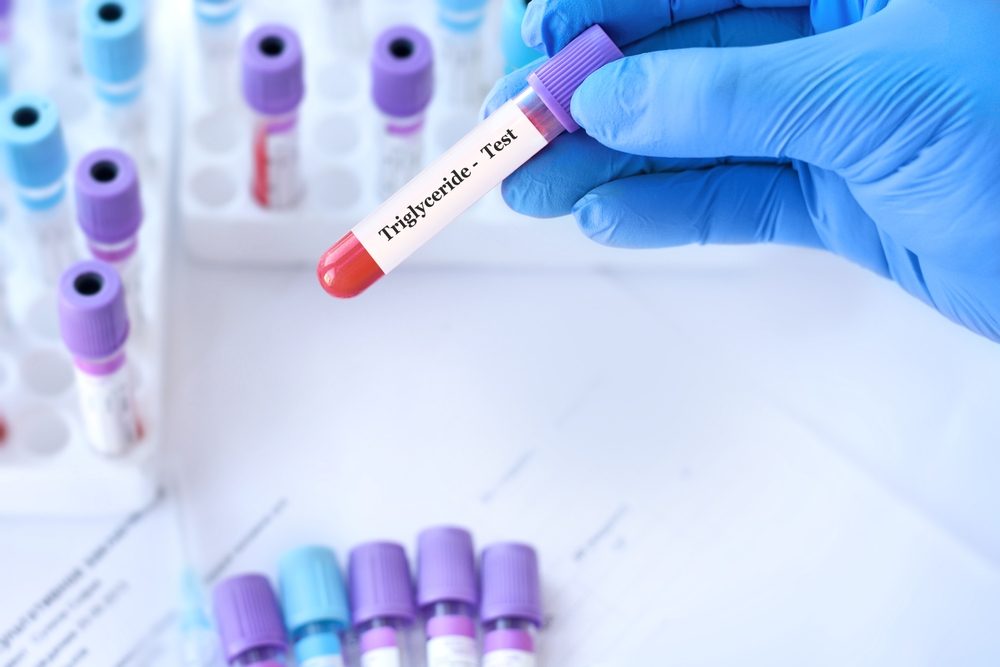 الدهون الثلاثية