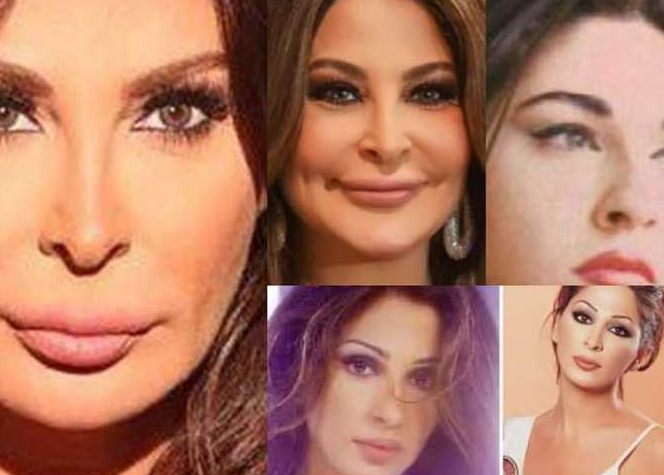 فنانات تشوهت وجوههن