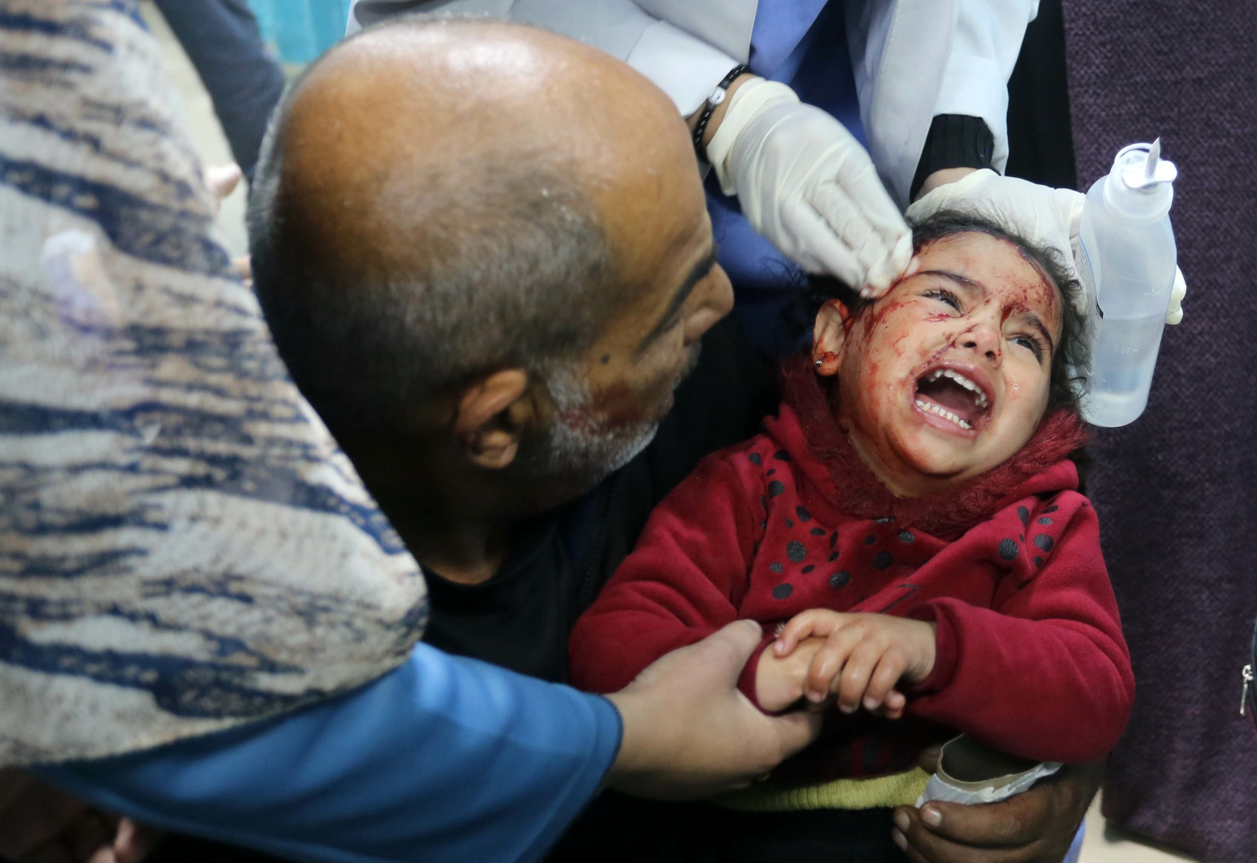 30 شهيداً حصيلة ضحايا القصف الإسرائيلي على غزة خلال 24 ساعة فقط.. واشتباكات ضارية بين الاحتلال والمقاومة 