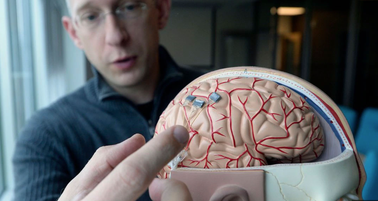 الشريحة الإلكترونية المزروعة