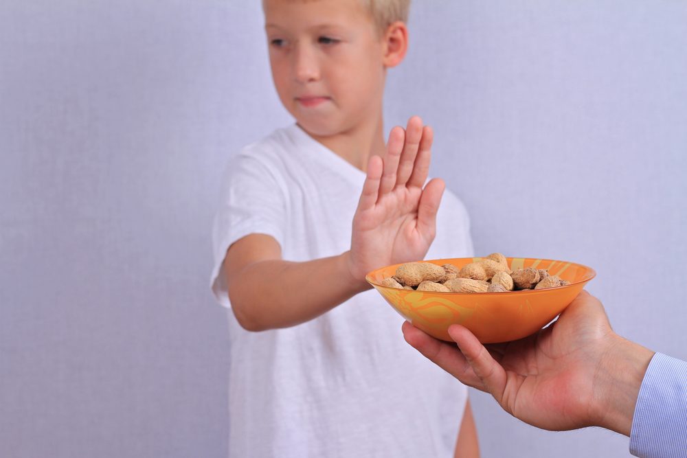 تأثير حساسية الفول السوداني على الأطفال| Shutterstock