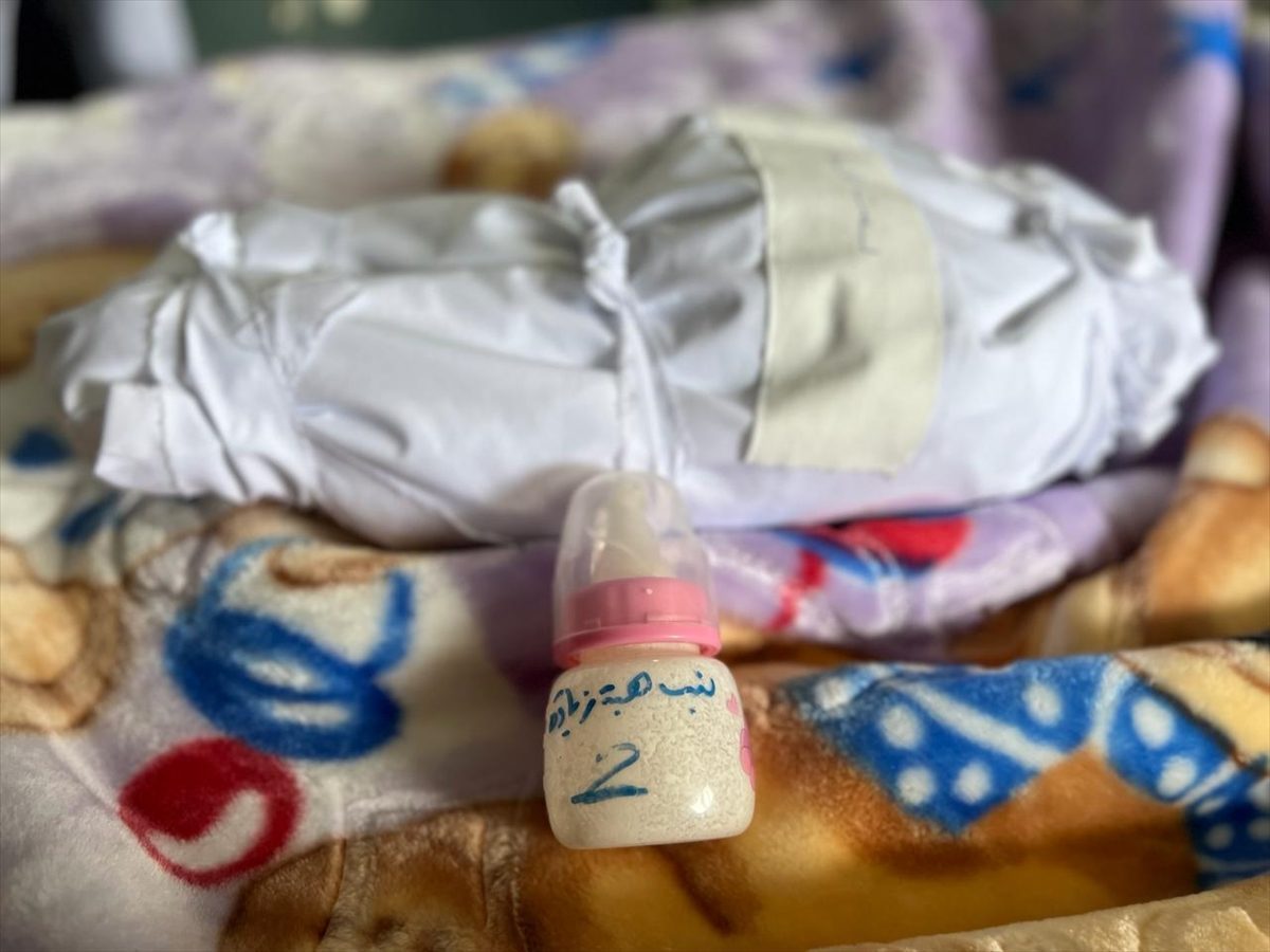 الرضيعة هبة زيادة استشهدت بسبب سوء التغذية/ الأناضول