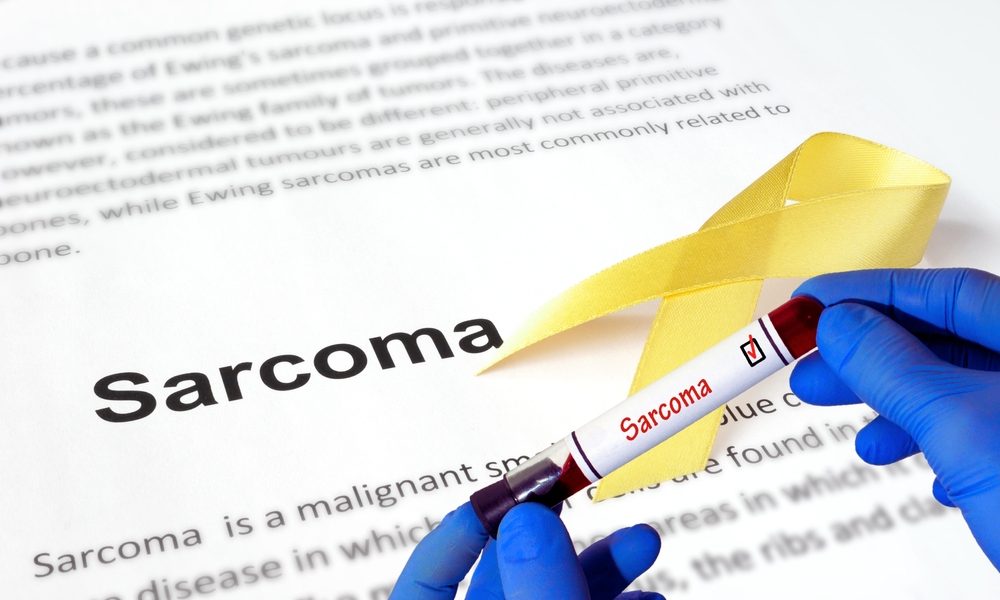 سرطان الساركوما