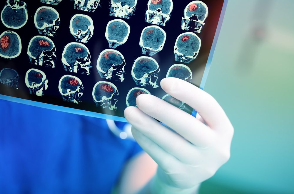 اكتشافات عن الدماغ | shutterstock