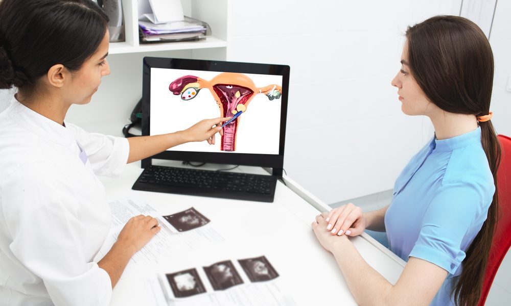 متلازمة تكيس المبيض ـ مصدر: shutterstock