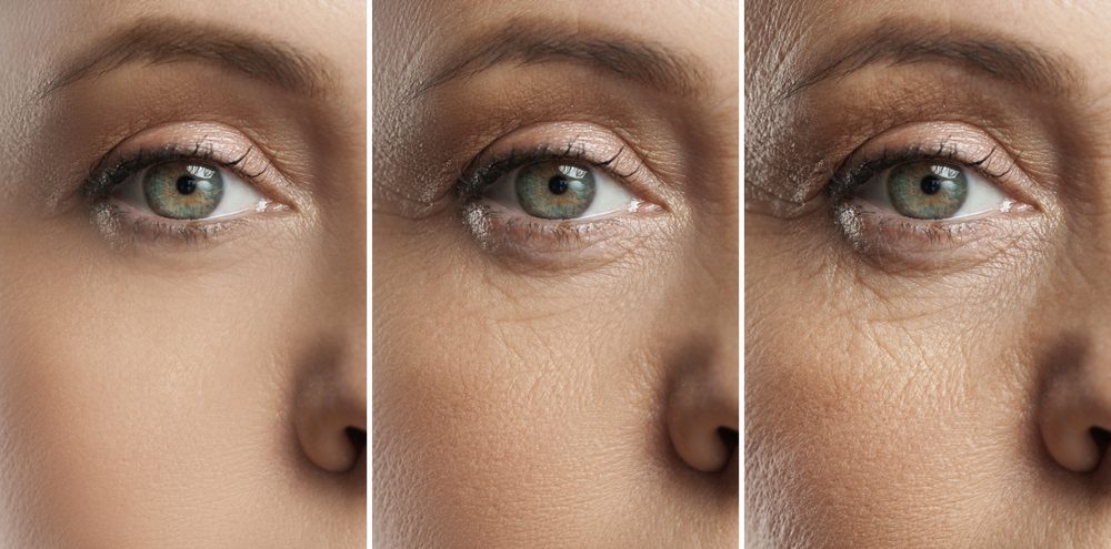 مراحل تغير البشرة| shutterstock