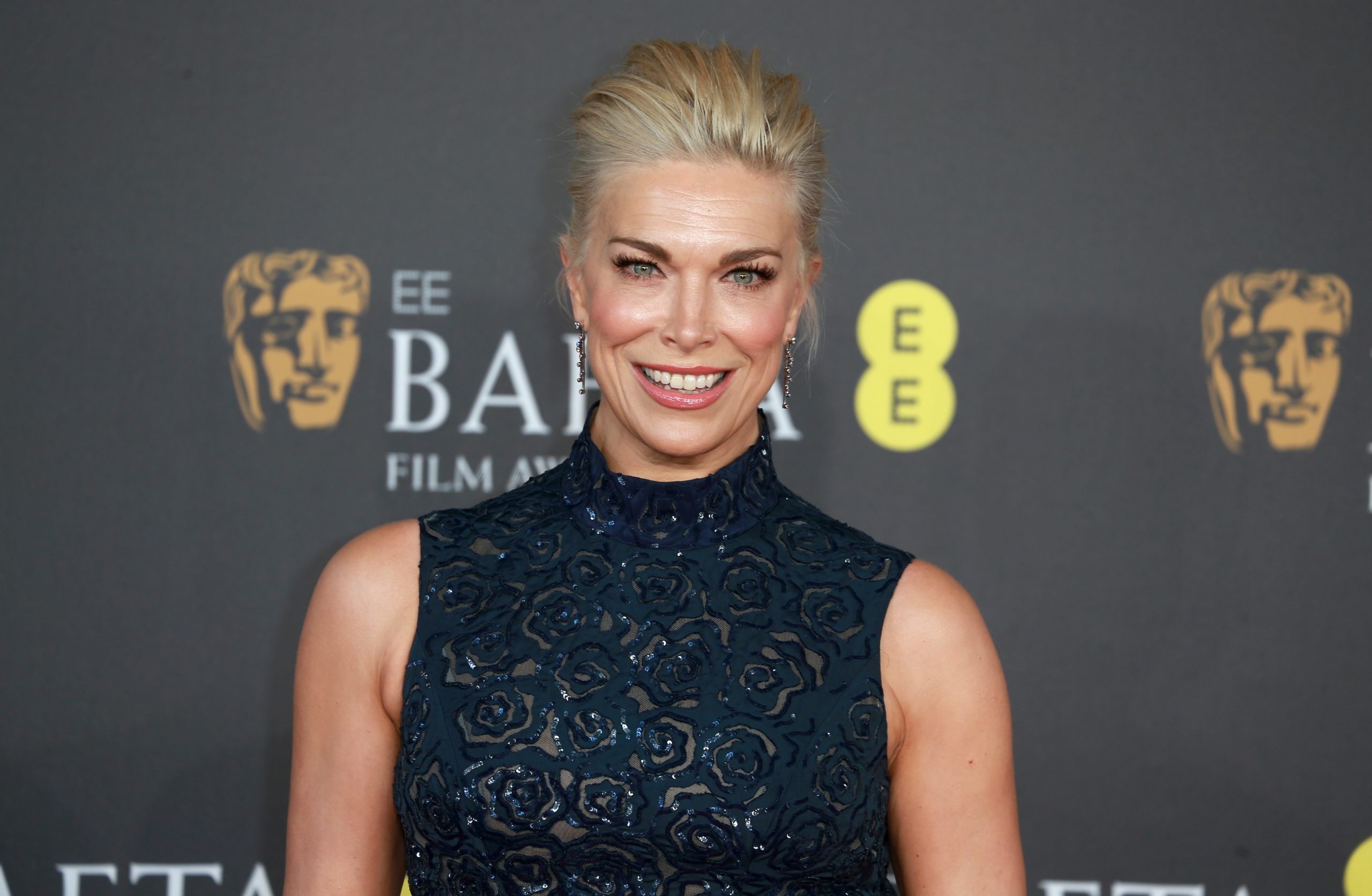 غضب هانا وادينغهام لطلب مصور أن تظهر ساقها (فيديو) | عربي بوست