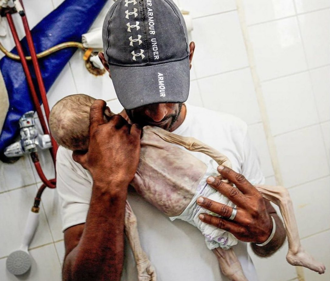 تحوَّل إلى هيكل عظمي.. وفاة الرضيع “فايز” بسبب الجوع ونقص الغذاء بغزة، وغضب واسع على مواقع التواصل