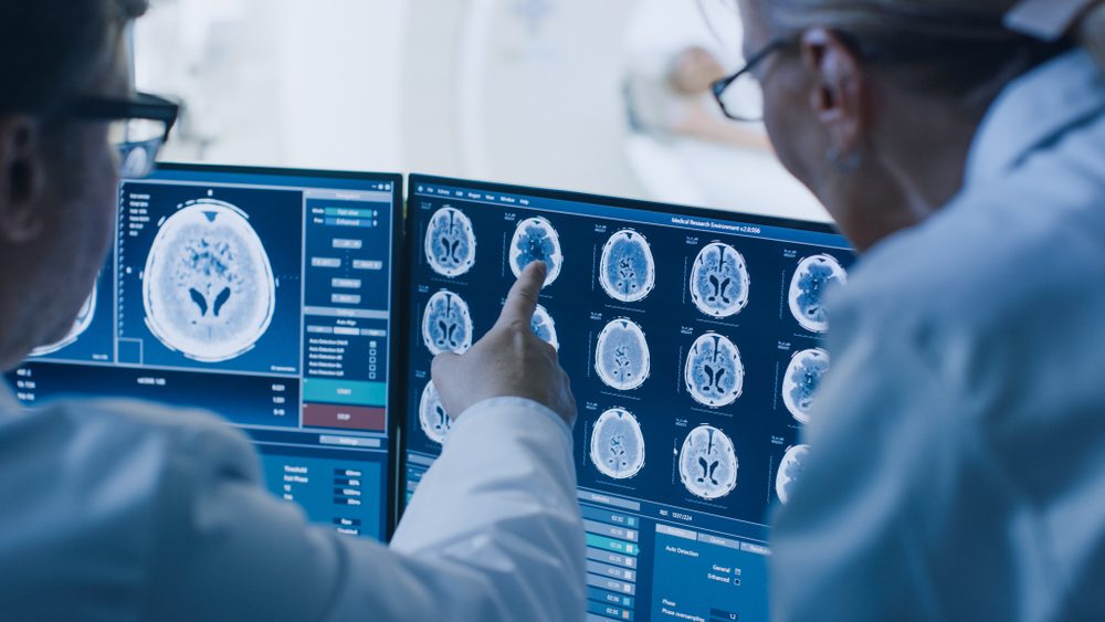 نتائج الرنين على الدماغ| shutterstock
