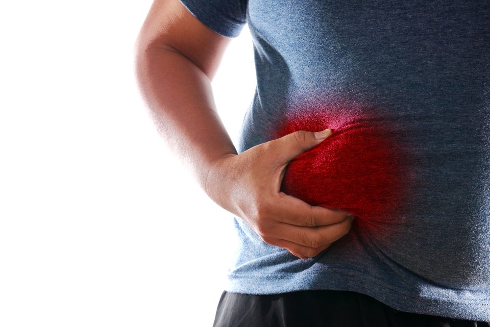 كيف يمكن تكسير دهون الجسم بدون جراحة؟| shutterstock