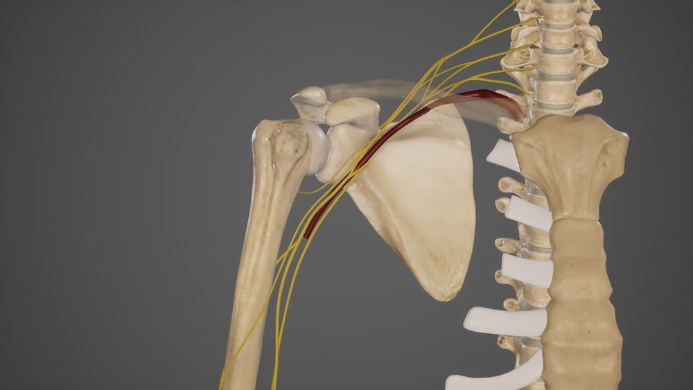 شكل الكتف عند التعرض لحالة التجنح| shutterstock
