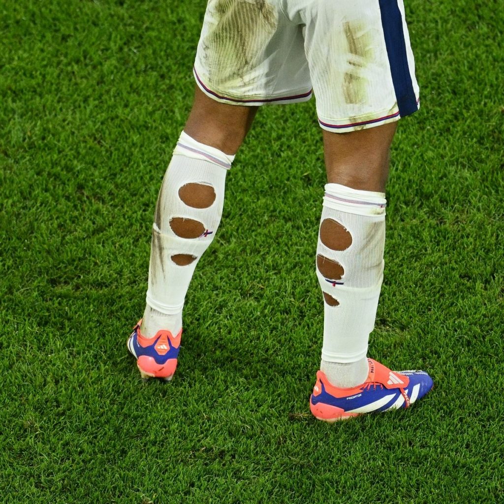 أسباب تمزيق جوارب اللاعبين