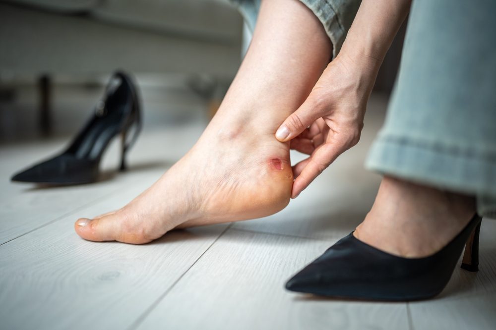 ألم ناتج عن الأحذية ذات الكعب العالي| shutterstock