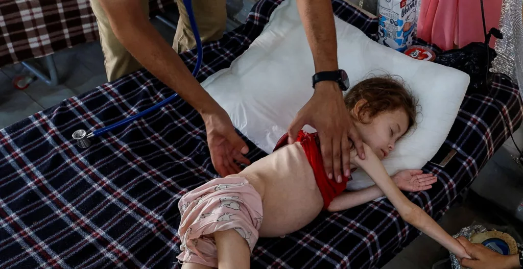 حرب التجويع التي يفرضها الاحتلال الإسرائيلي على غزة تقتل عشرات الأطفال خلال الـ48 ساعة الأخيرة - رويترز